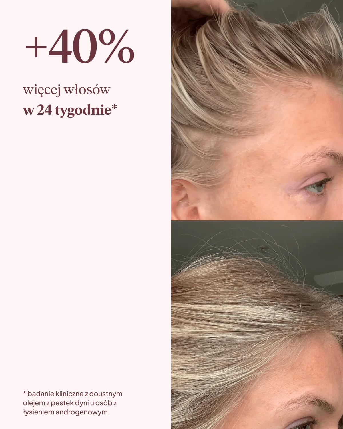 Zdjęcie produktu 6